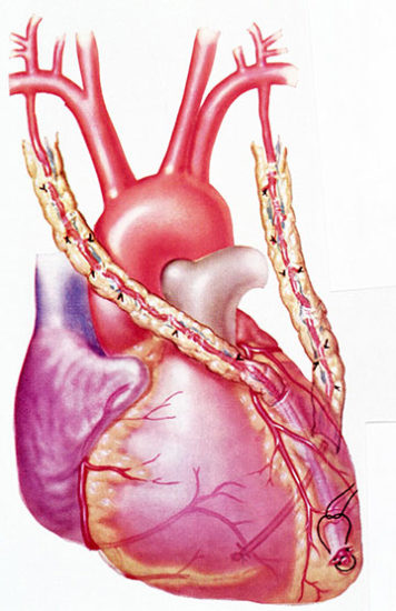 Coronary Artery Bypass Surgery - Cardiology Specialists